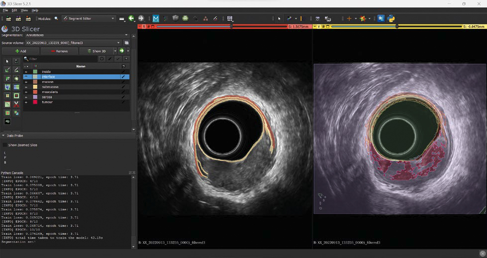ARCADIA: Image segmentation